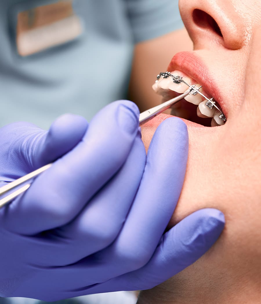 Dental Implants